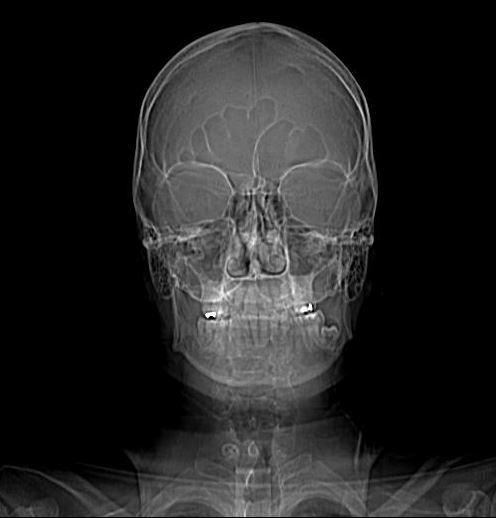 Santa pace che orrore.