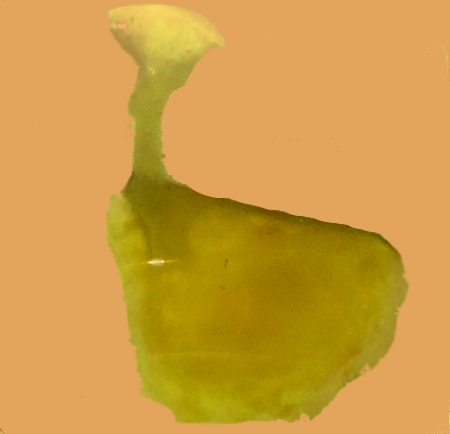 Arte Pop-esofagea (2)